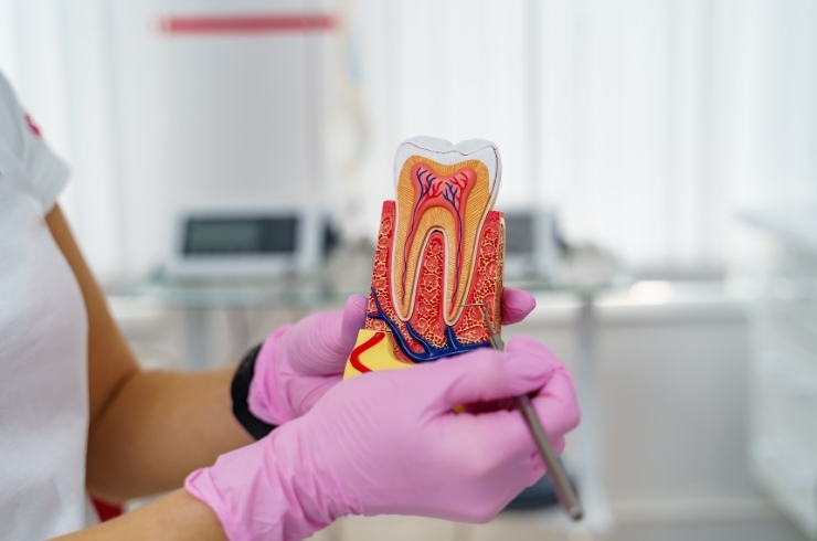 Root Canal Treatment, Skydents Dental, Dr. Lakshman Rao Kondapalli