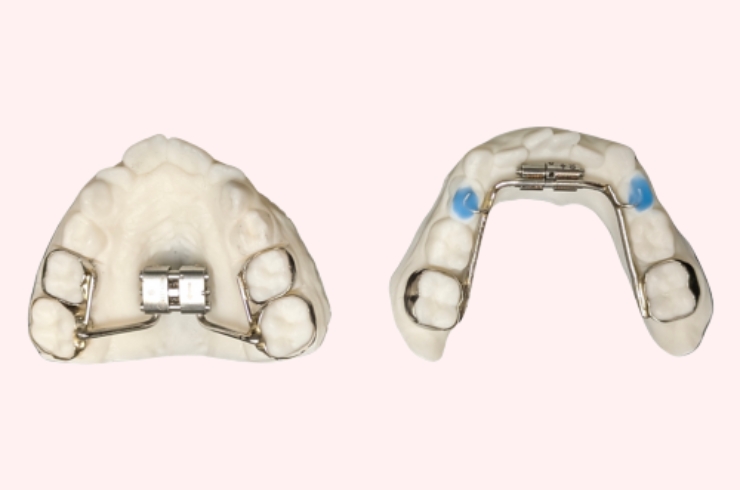 airway dentistry image, Skydents Dental, Dr. Lakshman Rao Kondapalli